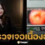 แฟนๆ ช็อก! ดาราสาว ซง จีฮโย ช็อก! หลังตรวจเจอเนื้องอกในลำไส้ใหญ่ ขนาด 5 มม. หมอหวั่นเป็น "มะเร็ง" สั่งตัดทิ้งด่วน