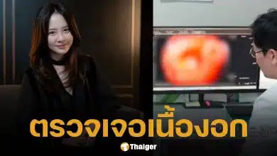 แฟนๆ ช็อก! ดาราสาว ซง จีฮโย ช็อก! หลังตรวจเจอเนื้องอกในลำไส้ใหญ่ ขนาด 5 มม. หมอหวั่นเป็น "มะเร็ง" สั่งตัดทิ้งด่วน