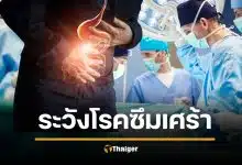 ผ่าตัดกระเพาะลดน้ำหนัก เสี่ยงทำซึมเศร้าหนัก ดูดซึมยาน้อยลง กินไม่อร่อย หวั่นจบชีวิต
