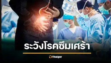 ผ่าตัดกระเพาะลดน้ำหนัก เสี่ยงทำซึมเศร้าหนัก ดูดซึมยาน้อยลง กินไม่อร่อย หวั่นจบชีวิต