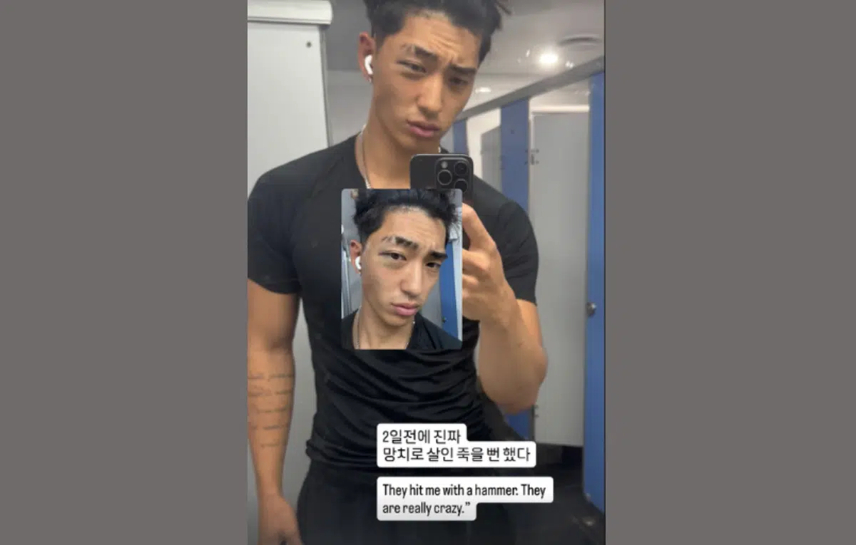 เกิดกระแสความไม่พอใจในซิดนีย์ หลังมีรายงานว่า "เด็กวัยรุ่น" ใช้ค้อนข่มขู่กลุ่มคนบริสุทธิ์