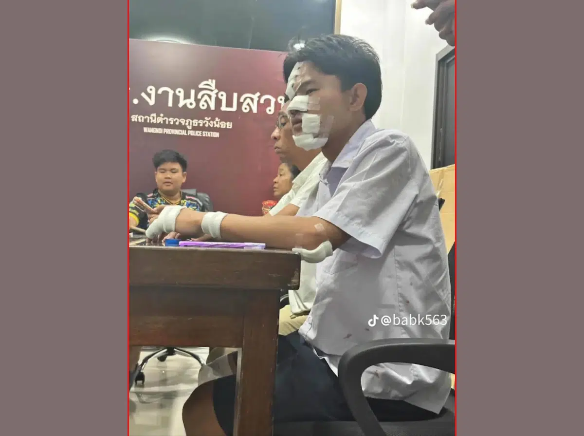 อัปเดตข่าวอุบัติเหตุไวรัล นักบิดวัยรุ่นปลอดภัยแต่มีบาดแผลจากเหตุการณ์ปะทะกันบนถนนอยุธยา