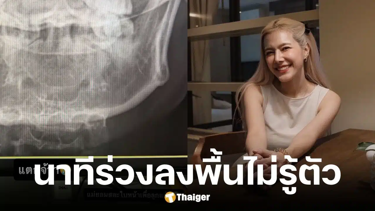 แนท ณัฐชา กรามแตก ถูกไม่กอล์ฟลูกชายหวยเข้าหน้า