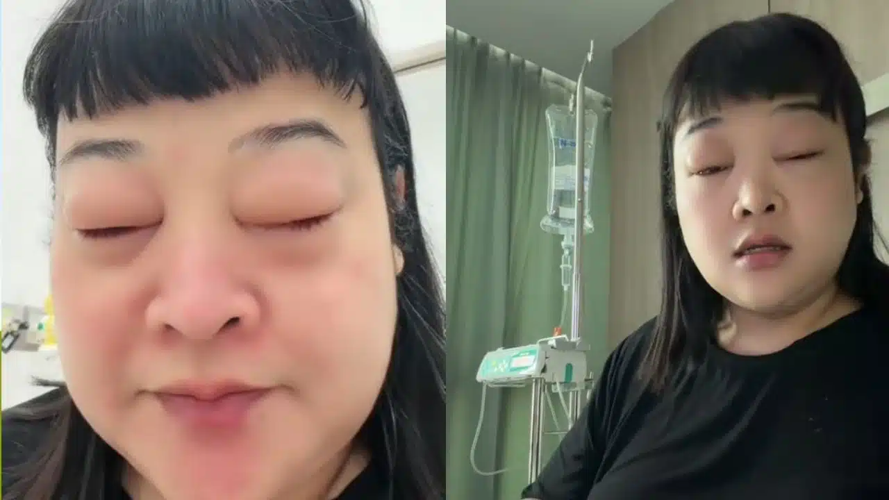 พัมกิ้น แพ้กุ้ง