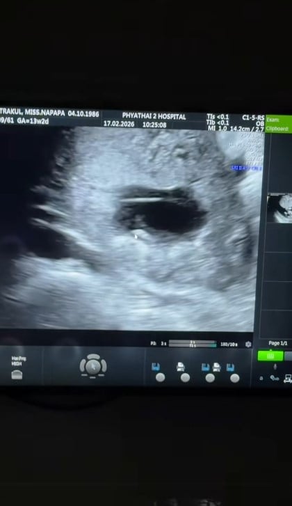 แพท ณปภา เปิดภาพอัลตราซาวด์