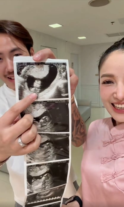 แพท ณปภา แจ้งข่าวท้องลูกคนที่ 2