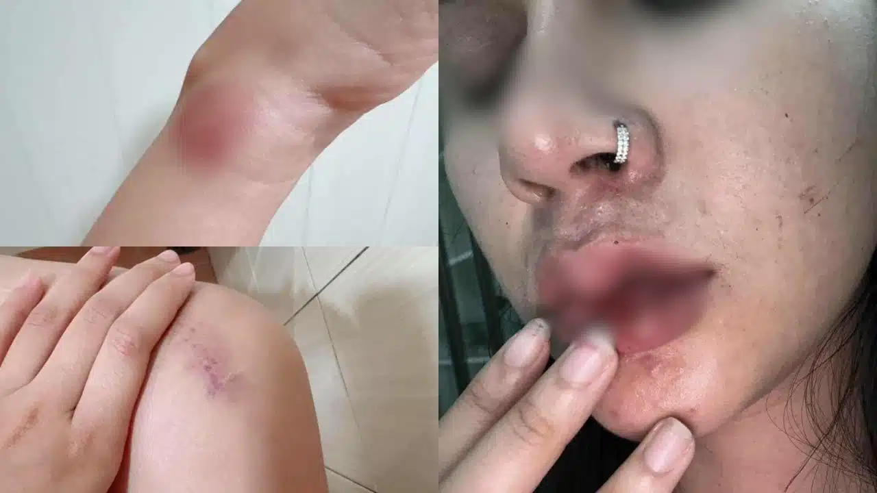 ครูไพบูลย์ โต้ปมทำร้ายร่างกายแฟนสาว-2