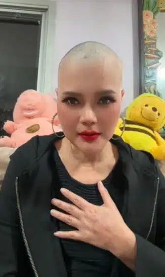 จันทร์จวง ดวงจันทร์ โกนผมสู้มะเร็ง ลั่น ผ่าตัดแล้วแต่มันไม่จบ-1