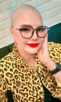 จันทร์จวง ดวงจันทร์ โกนผมสู้มะเร็ง ลั่น ผ่าตัดแล้วแต่มันไม่จบ-5