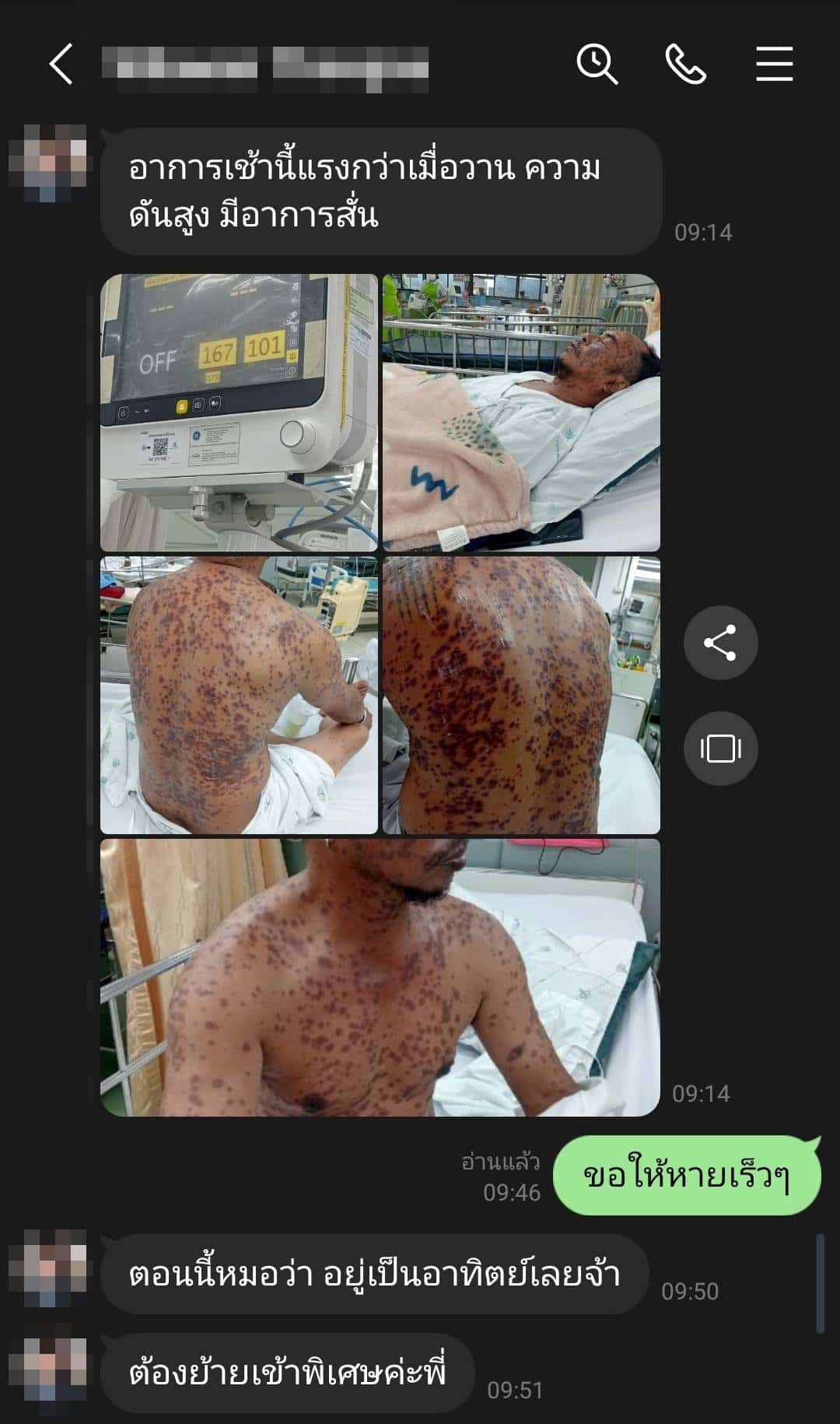 นิค อสรพิษวิทยา โพสต์ขอระดมทุนช่วย จิตอาสาจับงู จ.สุราษฎร์ธานี ป่วยหนัก-ค่ารักษาพุ่งสูง-4