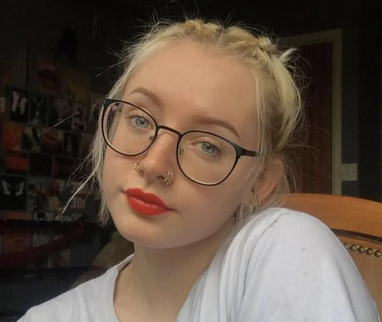 หญิงสาวดับสลด หลังกินยาพาราแก้ปวดฟัน จนเป็นพิษ ไตวาย เหตุเพราะกินแบบนี้