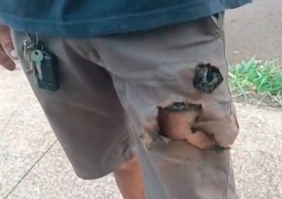 หนุ่มถูกสุนัขรุมขย้ำ เคราะห์ดี โทรศัพท์บึ้มคากางเกง ทำฝูงหมากระเจิง รอดตายปาฏิหาริย์-1