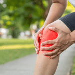 อาการออกกำลังกายแล้วปวดเข่า