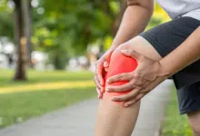 อาการออกกำลังกายแล้วปวดเข่า