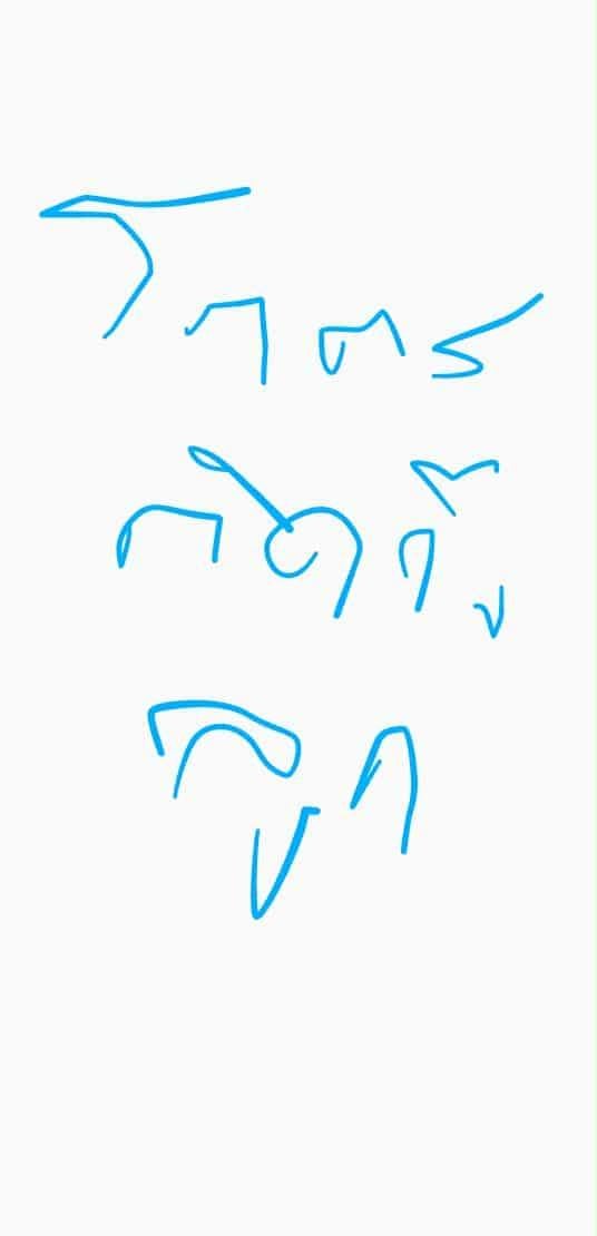 อาเธอร์ ฮูเซ็น เอลวิสเมืองไทย ป่วยกะทันหัน แพทย์ต้องใส่ท่อช่วยหายใจ-3