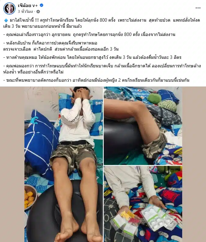 ขาของเด็กนักเรียนขณะนอนพักรักษาตัวบนเตียงตามคำสั่งแพทย์