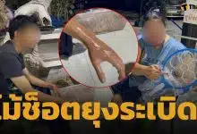 อุทาหรณ์! ไม้ตียุงไฟฟ้า ไม่มี มอก. ระเบิดใส่หน้า-แขน วัยรุ่นพานทองเจ็บหนัก