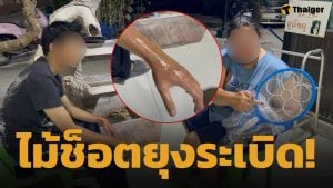 อุทาหรณ์! ไม้ตียุงไฟฟ้า ไม่มี มอก. ระเบิดใส่หน้า-แขน วัยรุ่นพานทองเจ็บหนัก