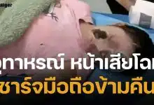 อุทาหรณ์ สาวชาร์จมือถือไว้ข้างหมอน บึ้มสนั่นกลางดึก ตื่นมาเสียโฉม ไฟครอกหนักกว่า 70%