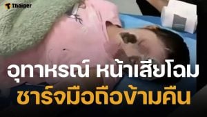 อุทาหรณ์ สาวชาร์จมือถือไว้ข้างหมอน บึ้มสนั่นกลางดึก ตื่นมาเสียโฉม ไฟครอกหนักกว่า 70%