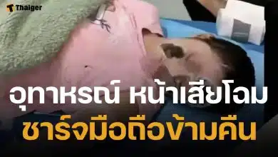 อุทาหรณ์ สาวชาร์จมือถือไว้ข้างหมอน บึ้มสนั่นกลางดึก ตื่นมาเสียโฉม ไฟครอกหนักกว่า 70%