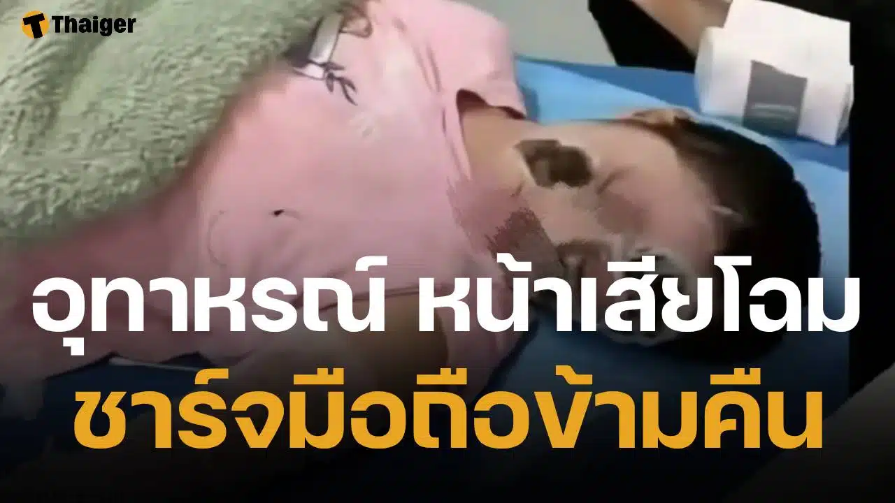 อุทาหรณ์ สาวชาร์จมือถือไว้ข้างหมอน บึ้มสนั่นกลางดึก ตื่นมาเสียโฉม ไฟครอกหนักกว่า 70%