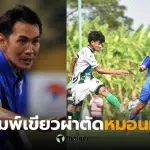 โค้ชจุ่น หมอนทอง ผ่าตัด