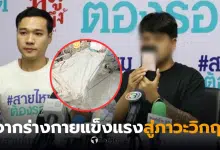 นักธุรกิจทำจมูกคลีนิกดัง