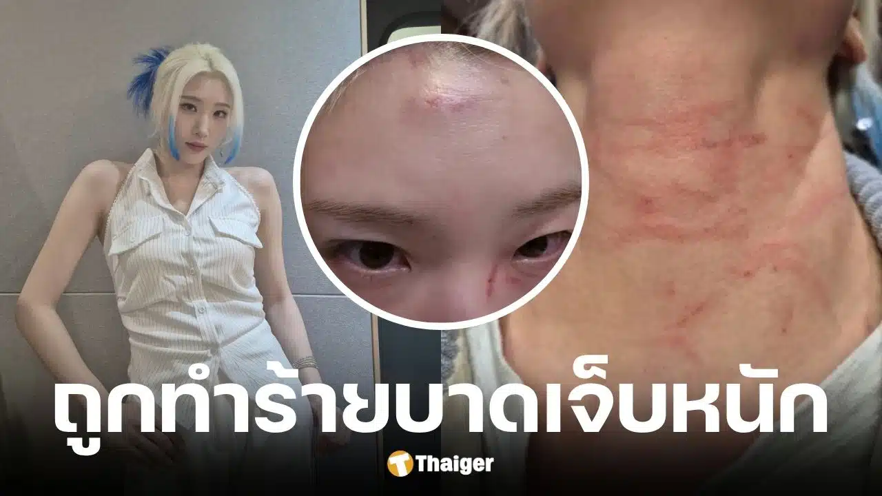 ฮยอนจอง Rolling Quartz โดนคนแปลกหน้าทำร้ายกลางถนน