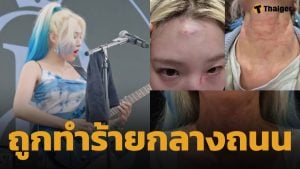 ช็อกแฟนๆ ไอดอลสาวเกาหลี ถูกทำร้ายร่างกาย ได้รับบาดเจ็บ ค่ายยกระดับดูแลศิลปินเข้มงวดขึ้น