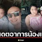 อี๊ด เชิญยิ้ม อัปเดตอาการ "น้องแวว" หลังผ่าตัดกระดูกใบหน้าผิดรูป เตรียมศัลยกรรมเพิ่ม