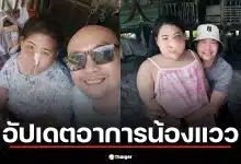 อี๊ด เชิญยิ้ม อัปเดตอาการ "น้องแวว" หลังผ่าตัดกระดูกใบหน้าผิดรูป เตรียมศัลยกรรมเพิ่ม