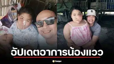 อี๊ด เชิญยิ้ม อัปเดตอาการ "น้องแวว" หลังผ่าตัดกระดูกใบหน้าผิดรูป เตรียมศัลยกรรมเพิ่ม