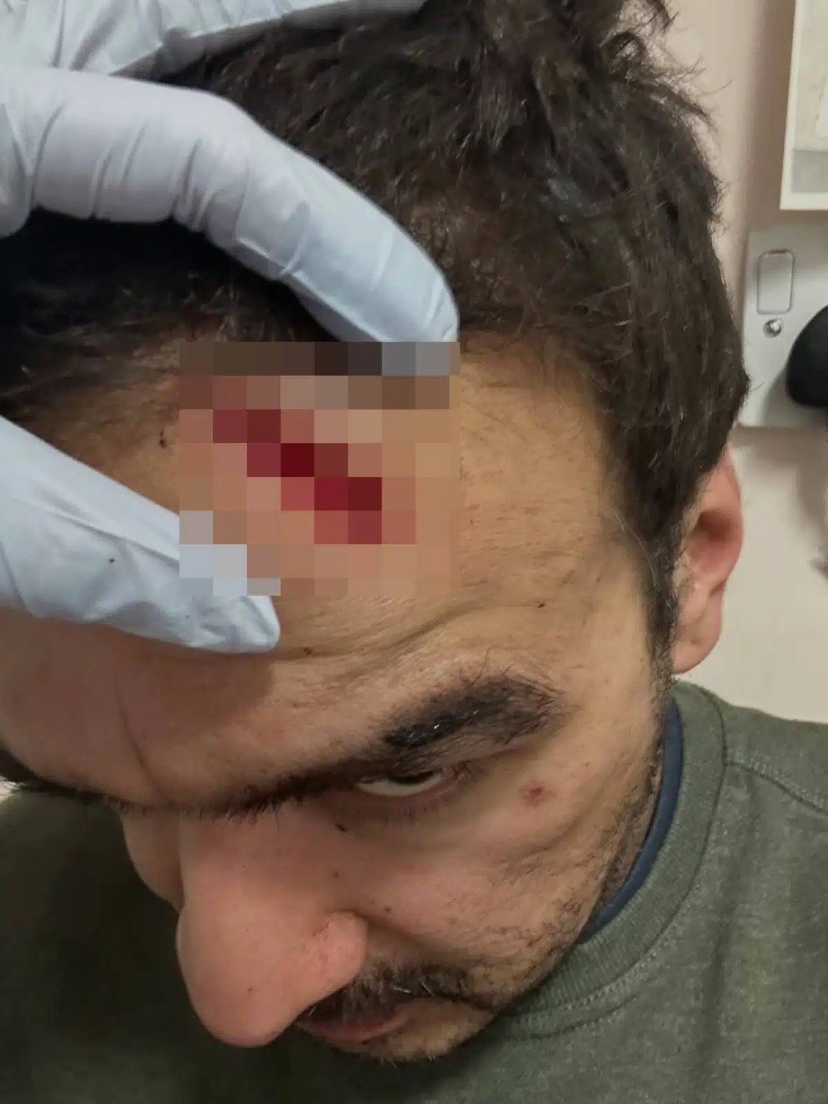 ดีตมือกีตาร์วง The Zutons ถูกทำร้ายสาหัสในลิเวอร์พูล