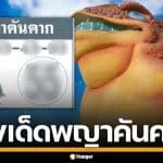 เลขเด็ด พญาคันคาก งวด 16/3/69 คัดเน้นๆ ปล่อยเลขท้าย 4 คู่ เลขเบิ้ลน่าลุ้น เซฟไว้เลย