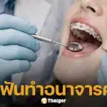 ฉาววงการแพทย์! รวบหมอฟันหื่น หลอกคนไข้สาว แลบลิ้น ก่อนฉวยโอกาสลวนลามคาคลินิก