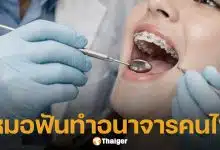 ฉาววงการแพทย์! รวบหมอฟันหื่น หลอกคนไข้สาว แลบลิ้น ก่อนฉวยโอกาสลวนลามคาคลินิก