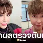 มัม ลาโคนิค ป่วยตับแข็ง