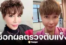 มัม ลาโคนิค ป่วยตับแข็ง