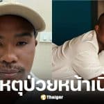 รัศมีแข ป่วยต่อมน้ำลายอักเสบหน้าเบี้ยว