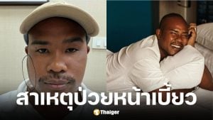 รัศมีแข ป่วยต่อมน้ำลายอักเสบหน้าเบี้ยว