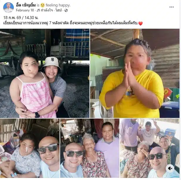 น้องแววเข้ารับการผ่าตัดที่ รพ.รามาธิบดี