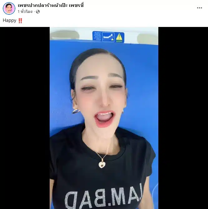 เพชร ปากปลาร้าหน้าเป๊ะ ให้ยา 66 เข็ม