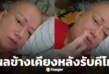 ส่งกำลังใจ แหม่ม ลิษา สุดทรมาน รักษามะเร็งเข็ม 9 ตุ่มแดงขึ้นเต็มหัว อาหารกินแล้วอาเจียน