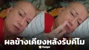 ส่งกำลังใจ แหม่ม ลิษา สุดทรมาน รักษามะเร็งเข็ม 9 ตุ่มแดงขึ้นเต็มหัว อาหารกินแล้วอาเจียน