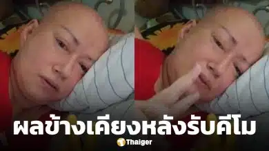 ส่งกำลังใจ แหม่ม ลิษา สุดทรมาน รักษามะเร็งเข็ม 9 ตุ่มแดงขึ้นเต็มหัว อาหารกินแล้วอาเจียน