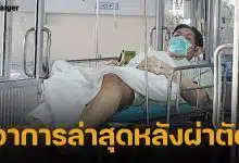 ภรรยาโยกเยก เชิญยิ้ม อัปเดตอาการตลกดัง หลังผ่าตัดกระดูกทับเส้นประสาท