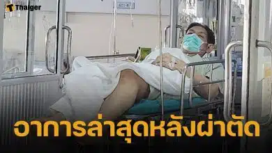 ภรรยาโยกเยก เชิญยิ้ม อัปเดตอาการตลกดัง หลังผ่าตัดกระดูกทับเส้นประสาท