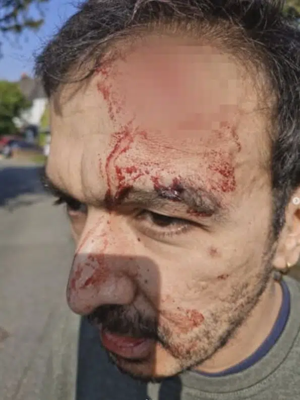 โบคาน โชวดูรี มือกีตาร์ฝีมือดีที่เป็นกำลังสำคัญของวง The Zutons