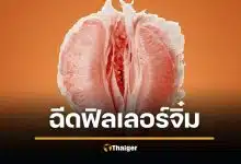 สวยสยอง! ฉีดฟิลเลอร์ช่องคลอด ดับ 2 ศพ อุดตันหลอดเลือดที่ปอด